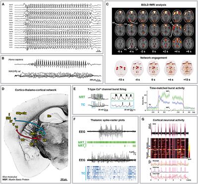 From Physiology to Pathology of Cortico-Thalamo-Cortical Oscillations: Astroglia as a Target for Further Research